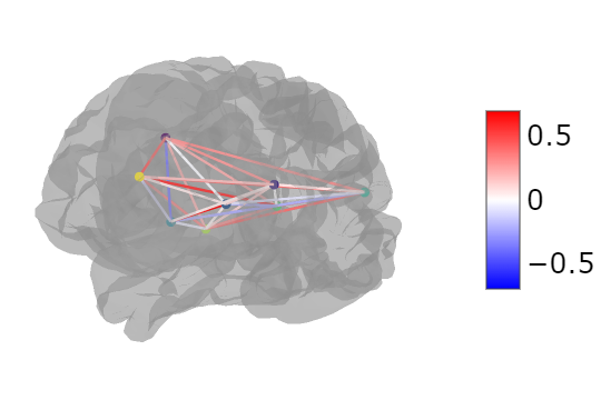 Visualization Output from Nilearn