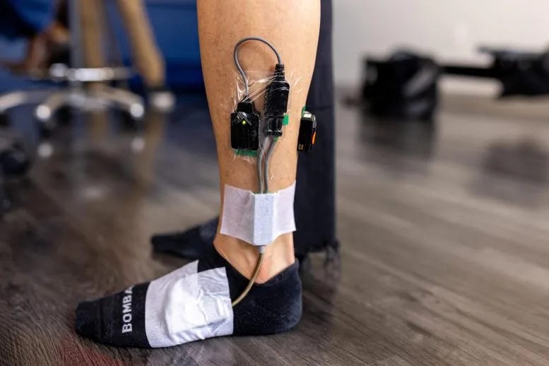 Anatomy of the Soleus Muscle