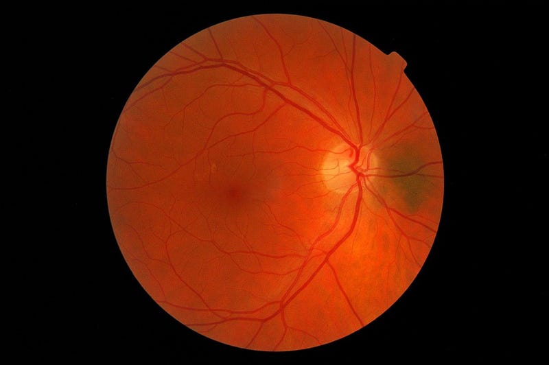 Ocular Anatomy: Layers of the Retina